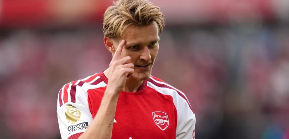 Jugador de Arsenal señalando su frente